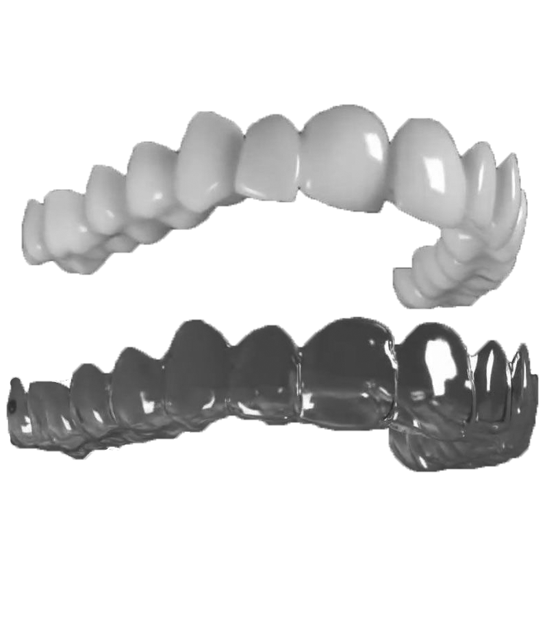 transparent-aligners
